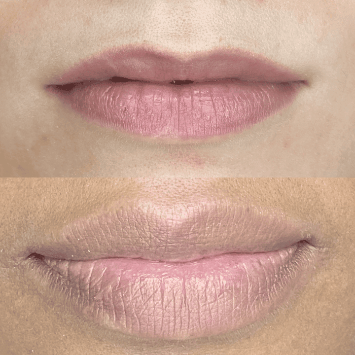 full-lips-color-before