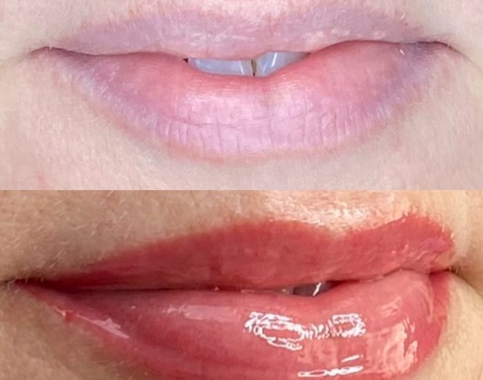 created by photogrid LIP BLUSH TATTOO BEFORE AND AFTER